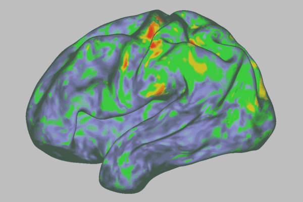 brain scan psilocybin